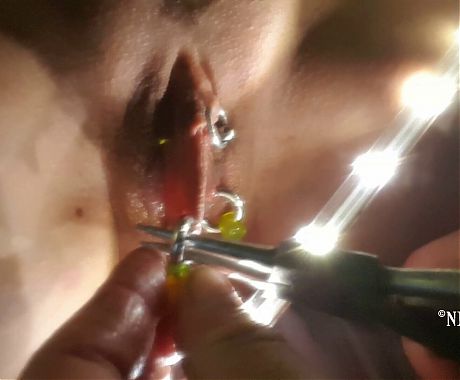 nippleringlover horny milf gets multiple rings in stretched pussy lip piercings